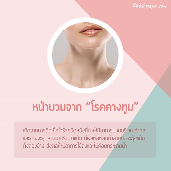 My Image 3